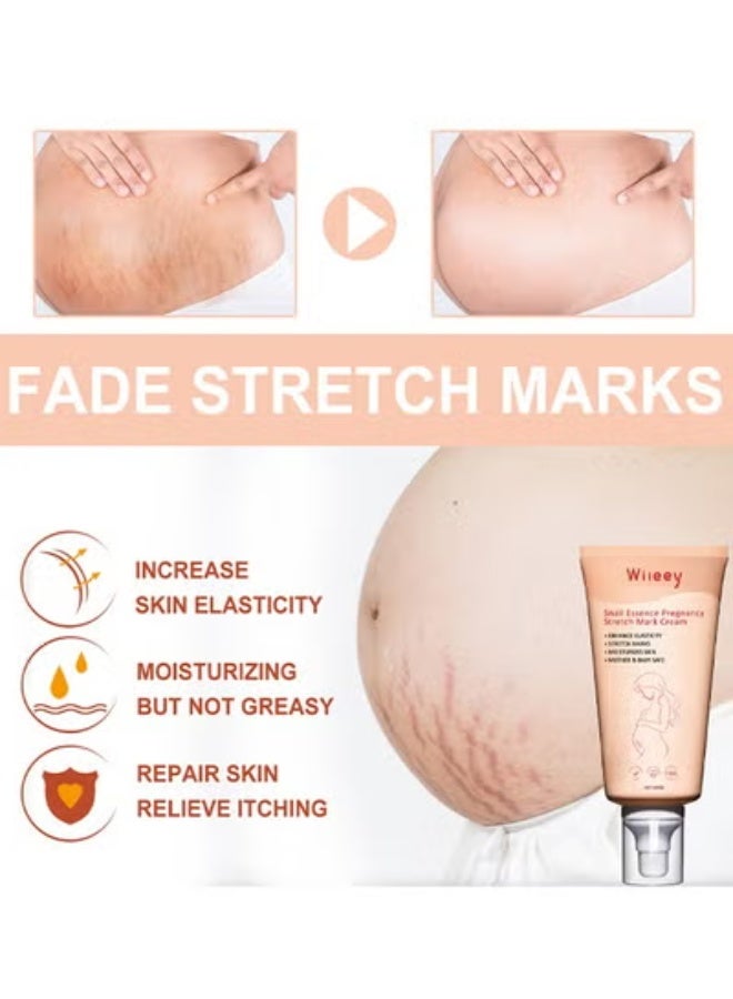 wiieey Snail Essence Pregnancy Stretch Mark Cream, Stretch Marks And Scar Removal Cream For Pregnancy, Stretch Marks Scar Belly Creams For Wrinkles, Obesity Fat Stretch Mark Moisturizing, Remove Marks - Image 4
